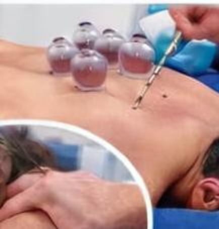 Cupping therapy session at JYORAM Physiotherapy Clinic